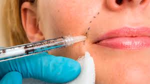 The Stigma Around Dermal Fillers: Why It's Time to Change the Conversation