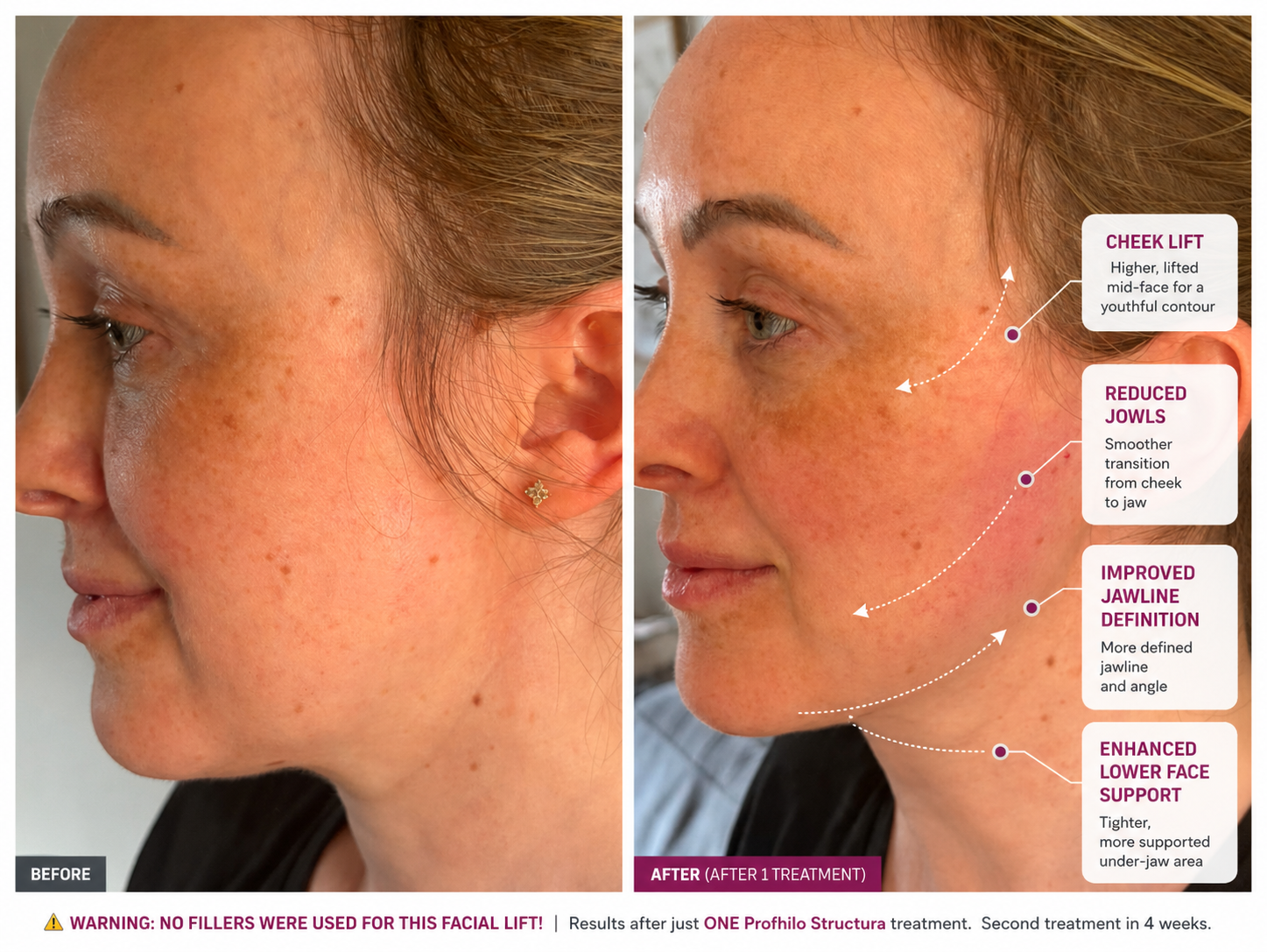 Aesthetic Treatments by Age: What We Recommend at Lumina Co-Lab, Appley Bridge