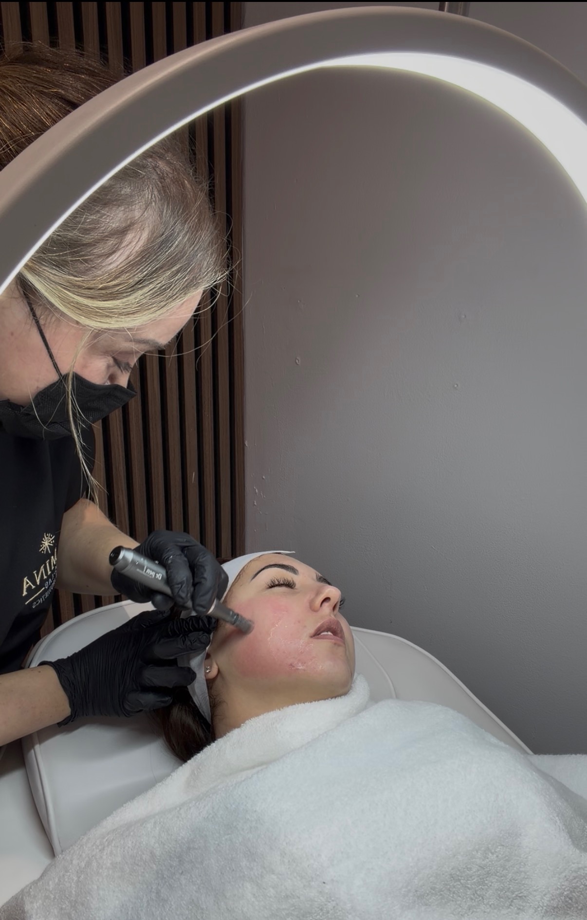 Microneedling with Exosomes: The Ultimate Skin Rejuvenation Treatment